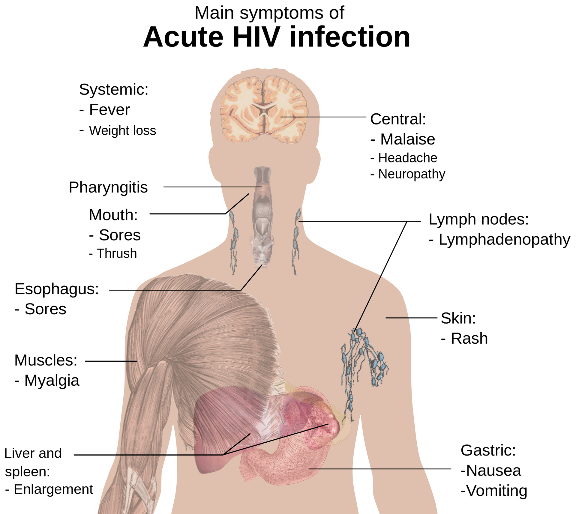 clinical presentation of hiv