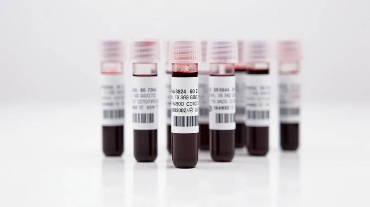 The image shows a clean white laboratory surface with several labeled blood sample vials, indicating various tests related to sexually transmitted diseases, including those for HIV infection and hepatitis viruses. Each vial is neatly arranged, emphasizing the importance of disease control and early diagnosis in managing infections.
